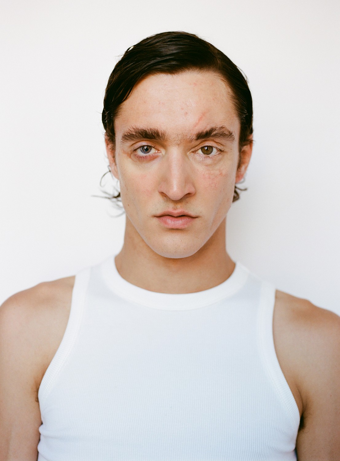 ÁLEX R